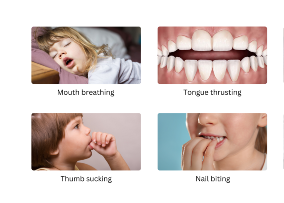 Habit Breaking Appliance